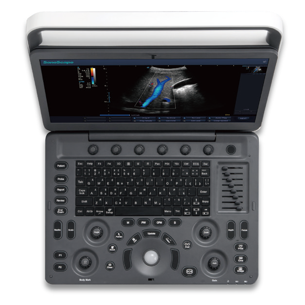 Ecógrafo Veterinario SonoScape E3V Doppler Color Portátil