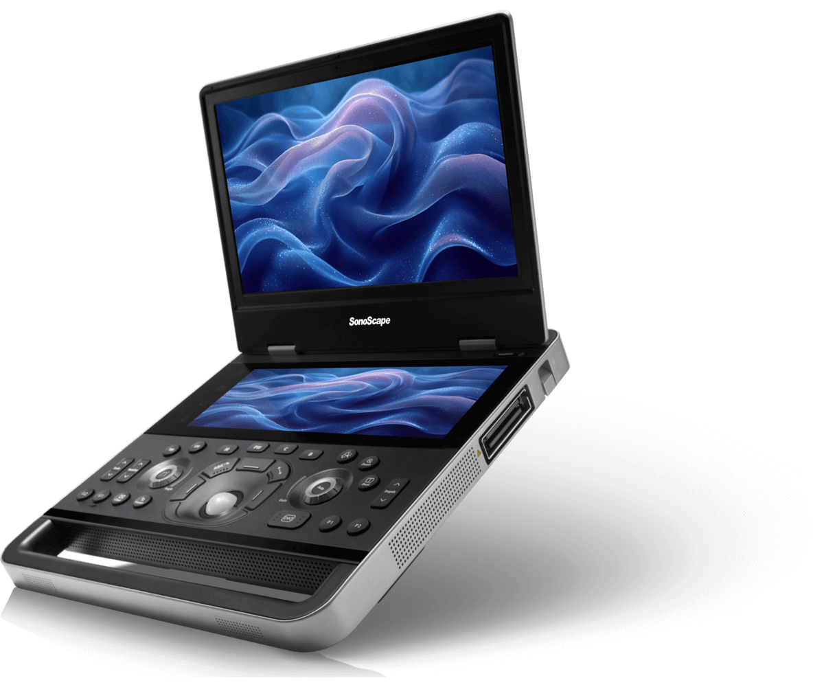 Ecógrafo Veterinario SonoScape ProPet X10 / E10 Doppler Color Portátil
