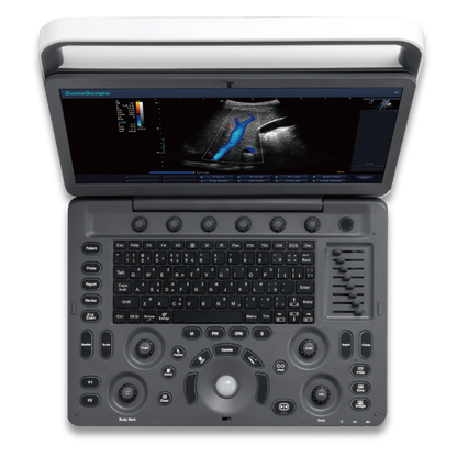 Ecógrafo Veterinario SonoScape E3V Doppler Color Portátil
