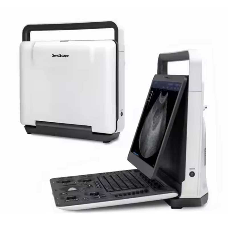 Escáner de Ultrasonido Veterinario Portátil SonoScape E1 E1V con una Sonda para Diagnóstico General y de Gestación Animal