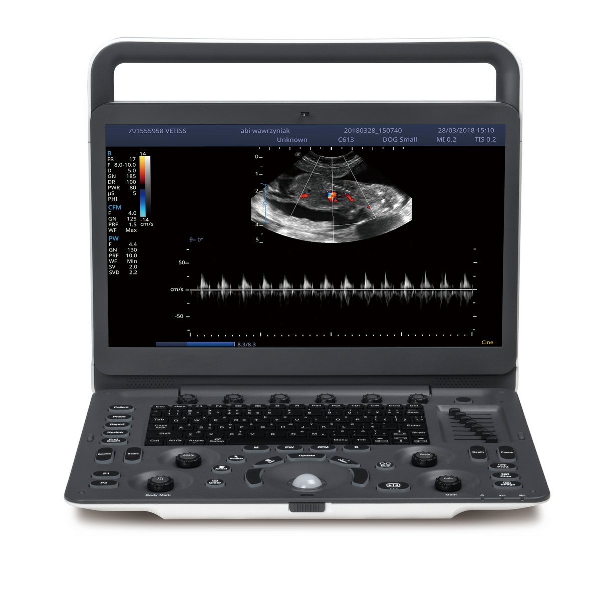 Ecógrafo Doppler Color Portátil SonoScape E2 E2V con un Transductor para Clínica Veterinaria y Hospital