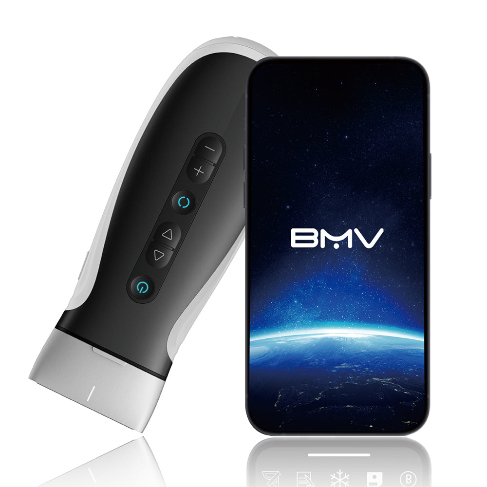 Ecógrafo Veterinario de Mano BMV MX9 EXP Vet Doppler Color
