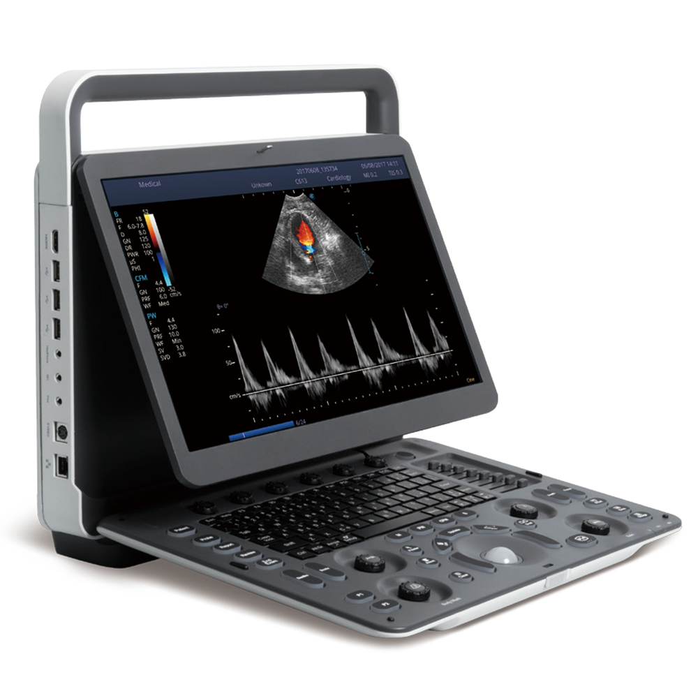 Ecógrafo Doppler Color Portátil SonoScape E2 E2V con un Transductor para Clínica Veterinaria y Hospital
