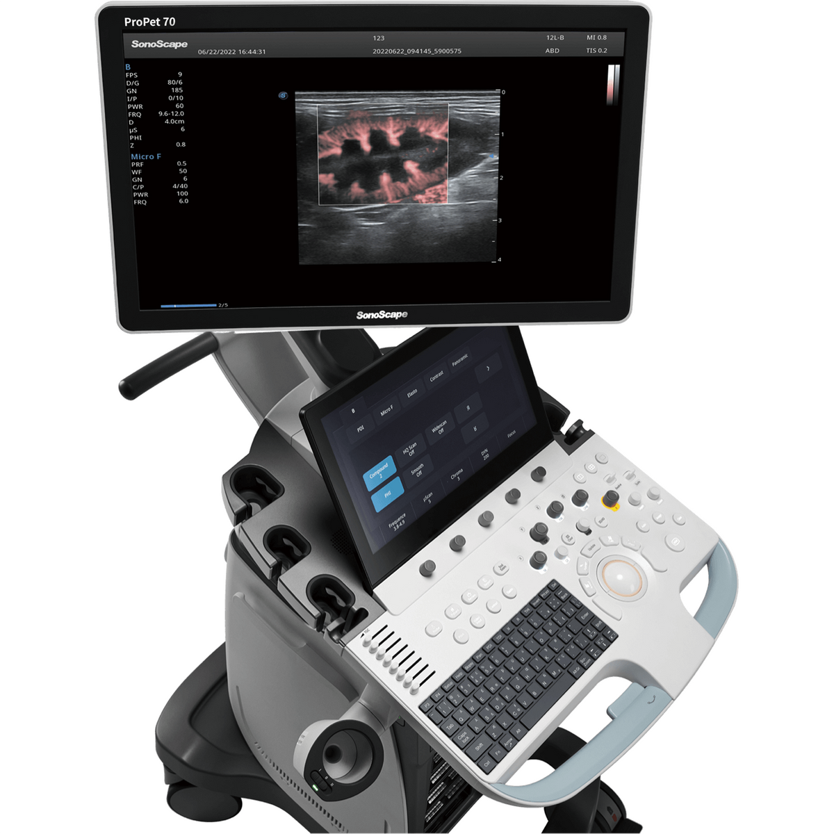 Ecógrafo Veterinario SonoScape ProPet 70 Doppler Color