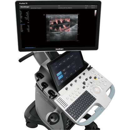 Ecógrafo Veterinario SonoScape ProPet 70 Doppler Color