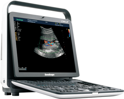 Ecógrafo Veterinario SonoScape S8 ExpV Doppler Color Portátil