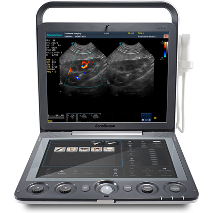 Ecógrafo Veterinario SonoScape S9V Doppler Color Portátil
