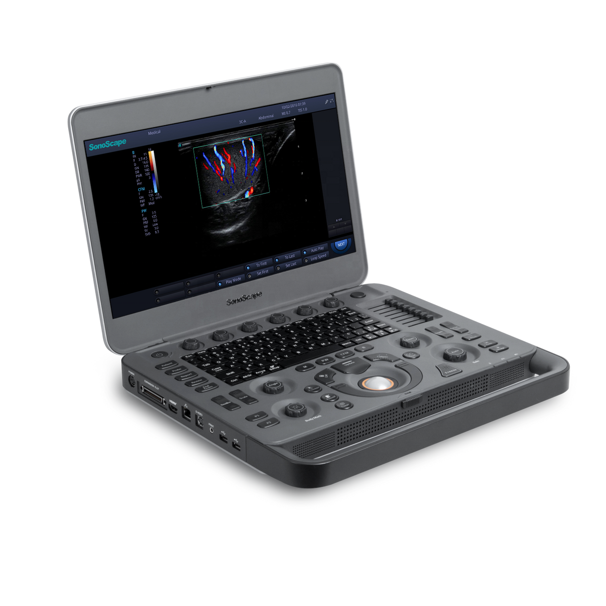 Ecógrafo Veterinario SonoScape X5V Doppler Color Portátil